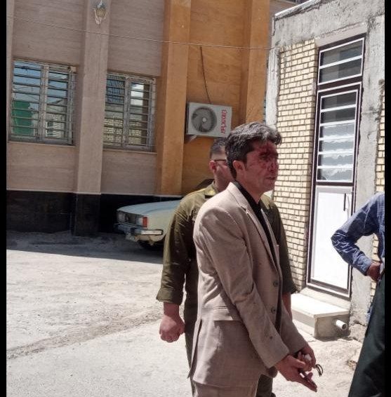 توسط مامور انتظامی فرمانداری هلیلان کتک کاری شدم
